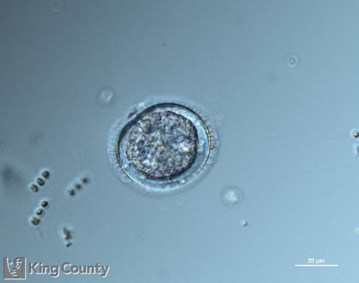 Photo of Diplopsalid dinoflagellates